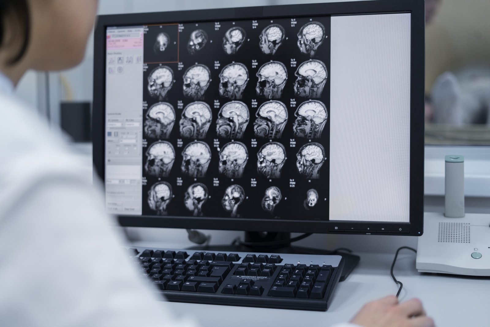 doctor looking ct scan scaled